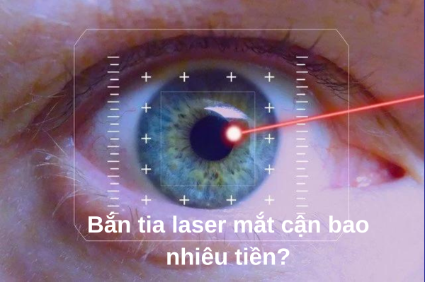 ban-tia-laser-mat-can-het-bao-nhieu-tien