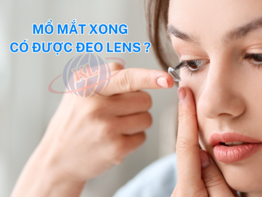 Mổ Mắt Xong Có Được Đeo Lens Không? Lưu Ý Quan Trọng Sau Phẫu Thuật